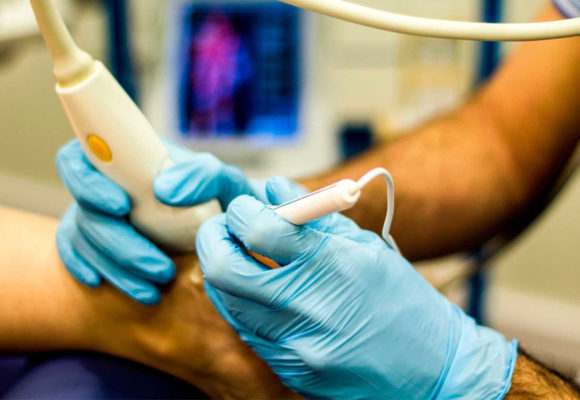 Punción Seca Ecoguiada