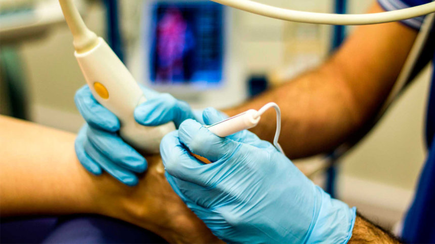 Punción Seca Ecoguiada